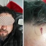 Video: Quilmeño fue asaltado y herido de un puntazo en Lanús cuando regresaba de ver el partido de Argentina